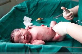 剖腹产视频,直观呈现母婴安全守护