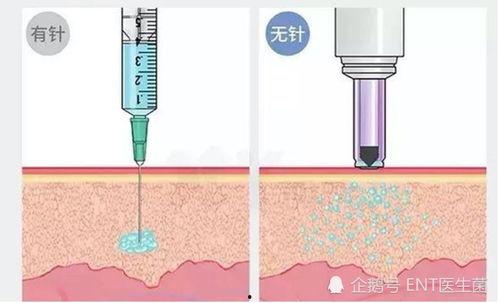 生长激素打针视频,儿童健康成长的关键一步