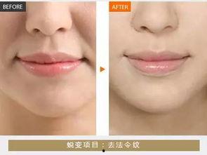 韩国艺兴整容,揭秘明星蜕变之路