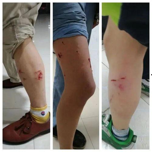 狗咬伤图片,紧急应对与预防措施解析