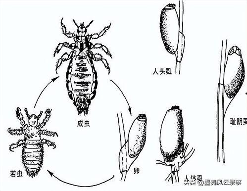 抓虱子视频,视频揭秘抓虱子全过程