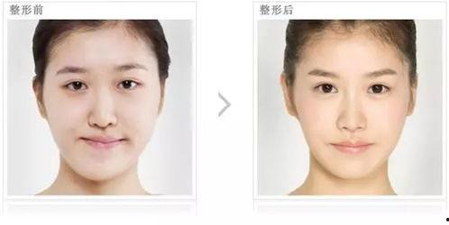 大小脸图片,图片解析面部不对称现象