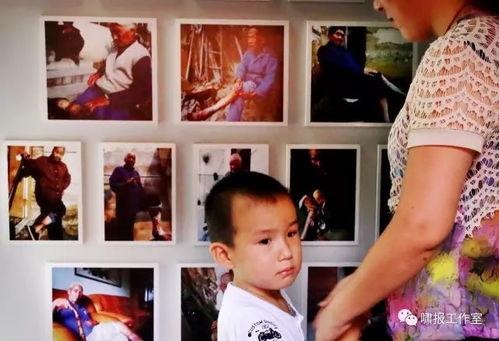 烂脚图片,揭秘脚部健康问题与防治策略