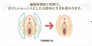 日本阴唇,探索其独特形态与美学意义