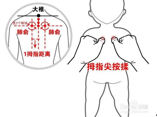 新生儿淋巴结图片大全,全面了解宝宝健康指标