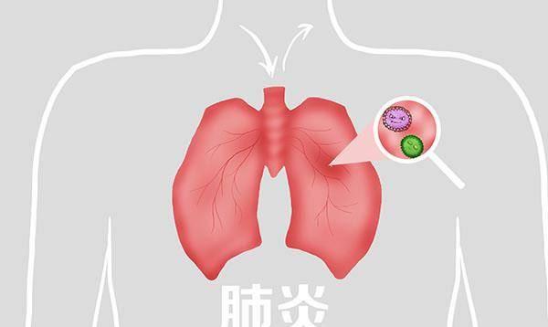 黑痰图片,揭示肺部健康的警示信号